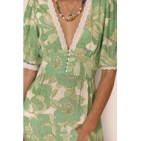 Women's Fashion Personalized Printed Lace Dress