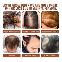 Hair Conditioner Pure Batana Oil Straightening Smoothing Hair Mask Anti Hair Loss Treatments Split Ends Damaged Fluffy Hair